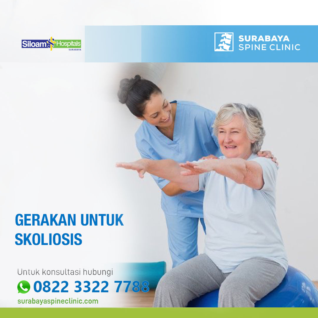 Gerakan Latihan untuk Skoliosis